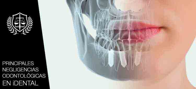 Principales negligencias Odontologicas