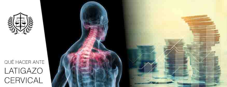 Que hacer ante latigazo cervical