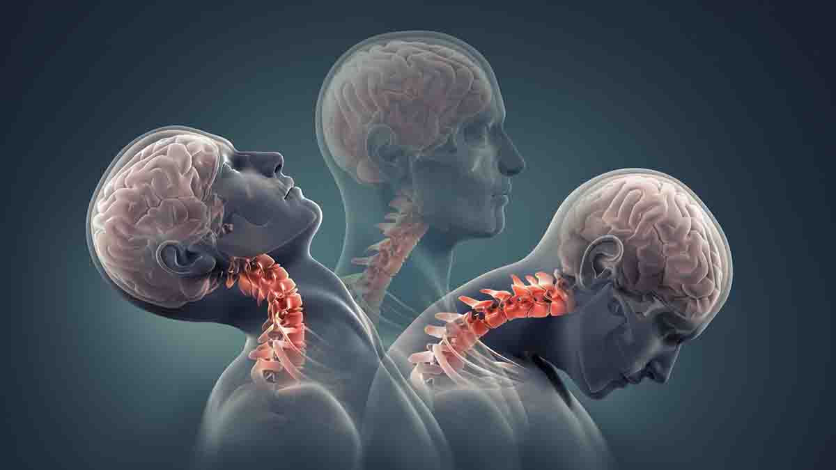 indemnizacion por un latigazo cervical