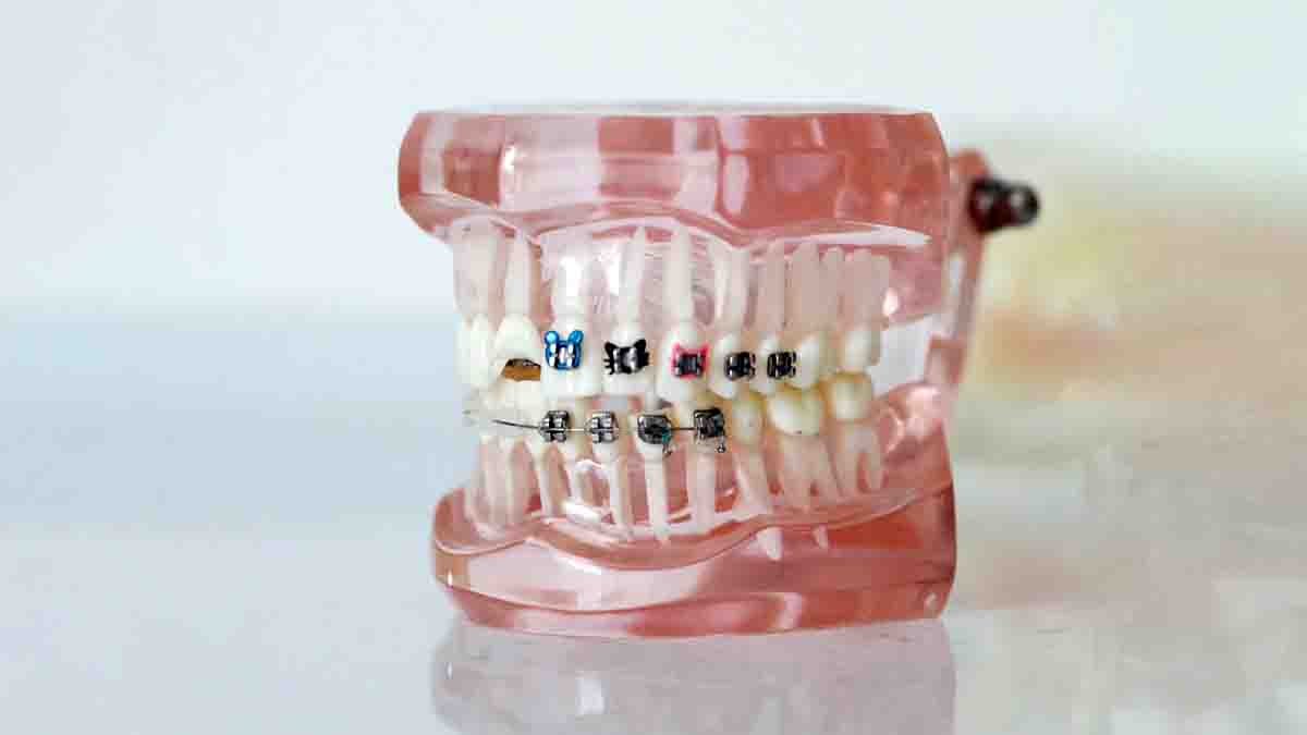 Perito en Ortodoncia y corrección de dientes. Negligencias